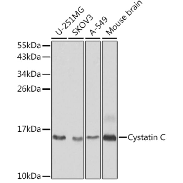 Western Blot - Anti-Cystatin C Antibody (A88396) - Antibodies.com