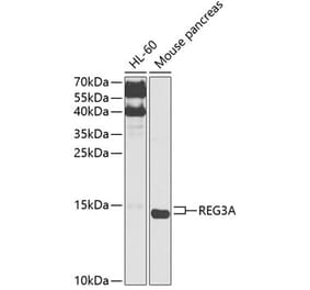 Western Blot - Anti-Reg3a Antibody (A88397) - Antibodies.com