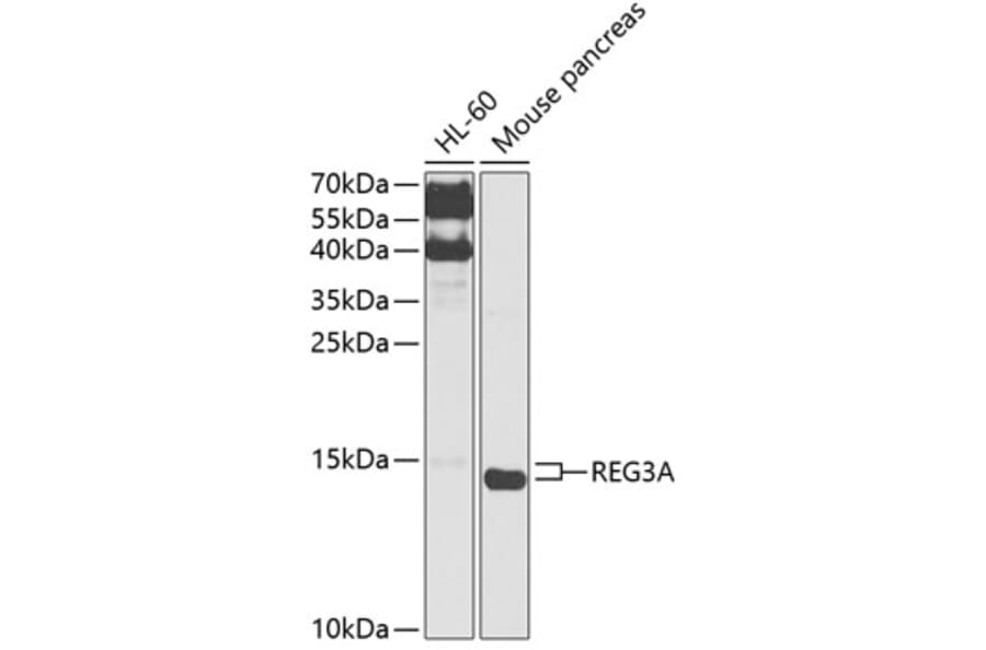 Western Blot - Anti-Reg3a Antibody (A88397) - Antibodies.com