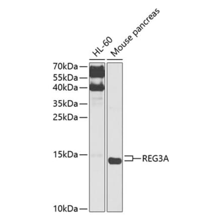 Western Blot - Anti-Reg3a Antibody (A88397) - Antibodies.com