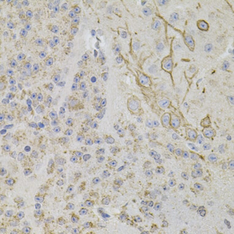 Immunohistochemistry - Anti-Reg3a Antibody (A88397) - Antibodies.com