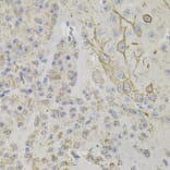 Immunohistochemistry - Anti-Reg3a Antibody (A88397) - Antibodies.com