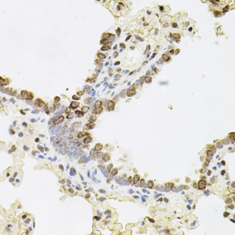 Immunohistochemistry - Anti-Reg3a Antibody (A88397) - Antibodies.com
