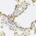 Immunohistochemistry - Anti-Reg3a Antibody (A88397) - Antibodies.com