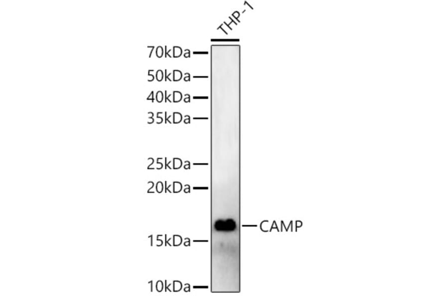Western Blot - Anti-Cathelicidin/CLP Antibody (A88398) - Antibodies.com