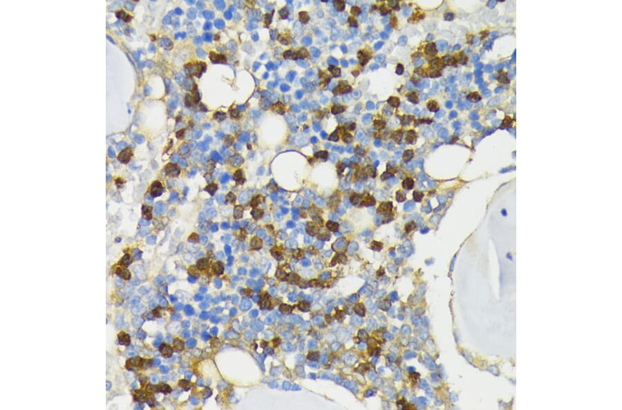 Immunohistochemistry - Anti-Cathelicidin/CLP Antibody (A88398) - Antibodies.com