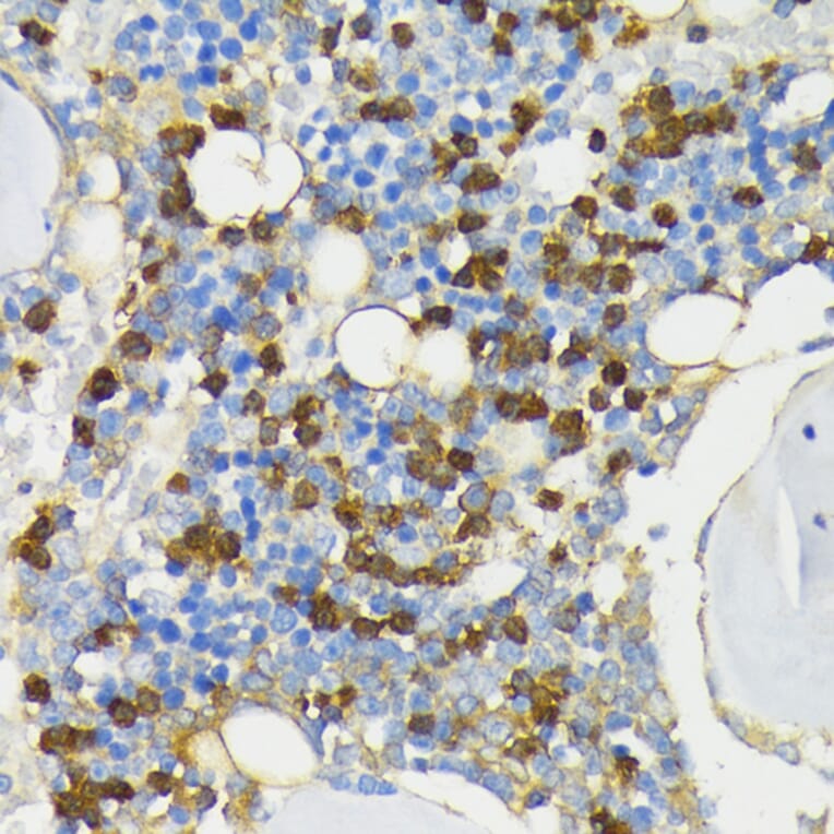 Immunohistochemistry - Anti-Cathelicidin/CLP Antibody (A88398) - Antibodies.com