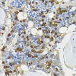 Immunohistochemistry - Anti-Cathelicidin/CLP Antibody (A88398) - Antibodies.com