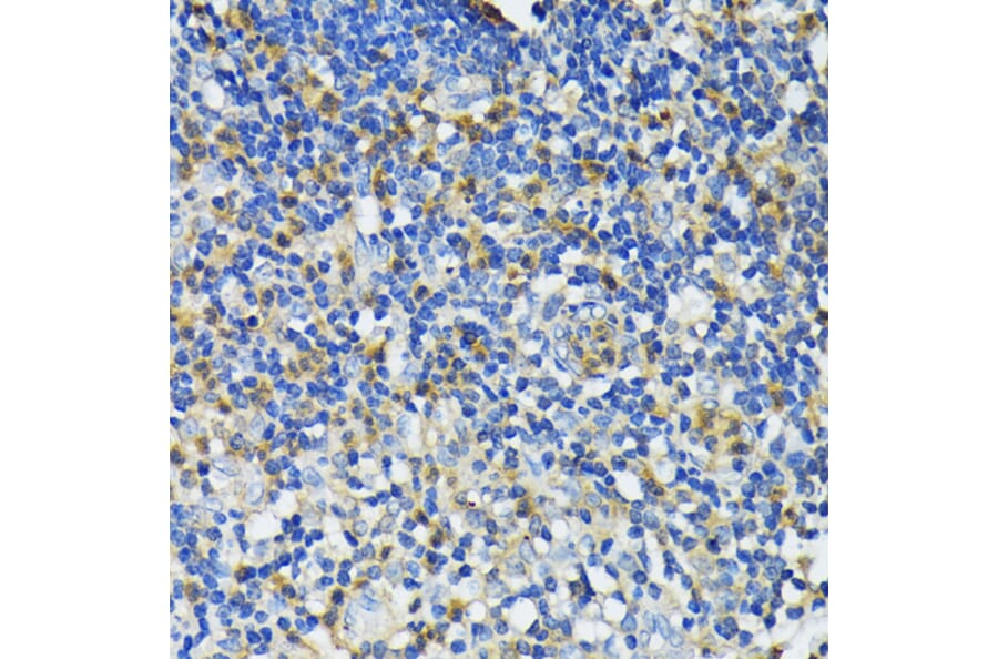 Immunohistochemistry - Anti-Cathelicidin/CLP Antibody (A88398) - Antibodies.com