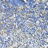Immunohistochemistry - Anti-Cathelicidin/CLP Antibody (A88398) - Antibodies.com