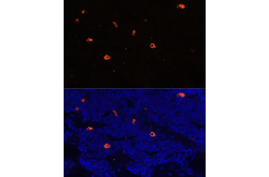 Immunofluorescence - Anti-Cathelicidin/CLP Antibody (A88398) - Antibodies.com