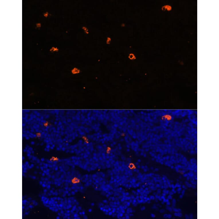 Immunofluorescence - Anti-Cathelicidin/CLP Antibody (A88398) - Antibodies.com