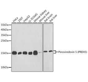 Western Blot - Anti-Peroxiredoxin 5 Antibody (A88399) - Antibodies.com