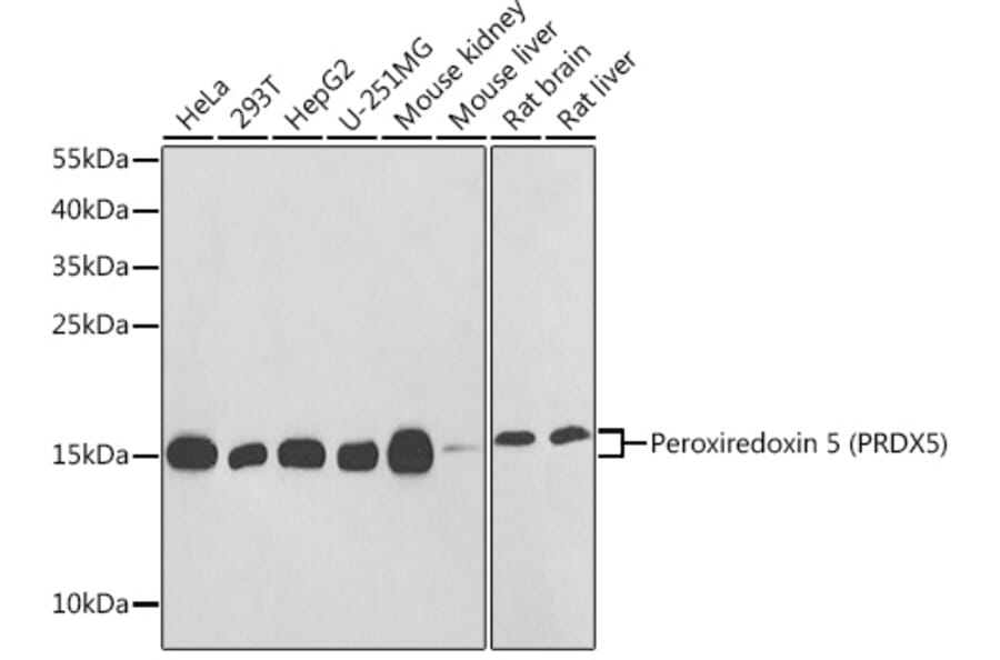 Western Blot - Anti-Peroxiredoxin 5 Antibody (A88399) - Antibodies.com