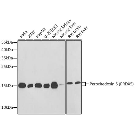 Western Blot - Anti-Peroxiredoxin 5 Antibody (A88399) - Antibodies.com