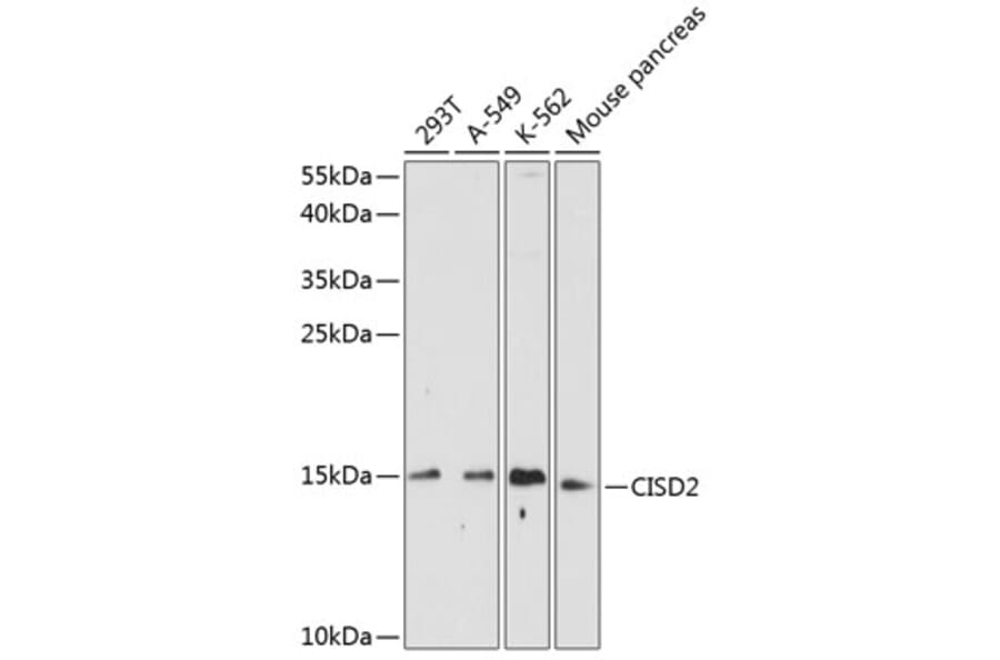 Western Blot - Anti-CISD2 Antibody (A88400) - Antibodies.com