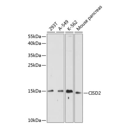 Western Blot - Anti-CISD2 Antibody (A88400) - Antibodies.com