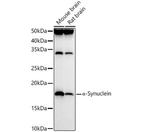 Western Blot - Anti-Alpha-synuclein Antibody (A88401) - Antibodies.com