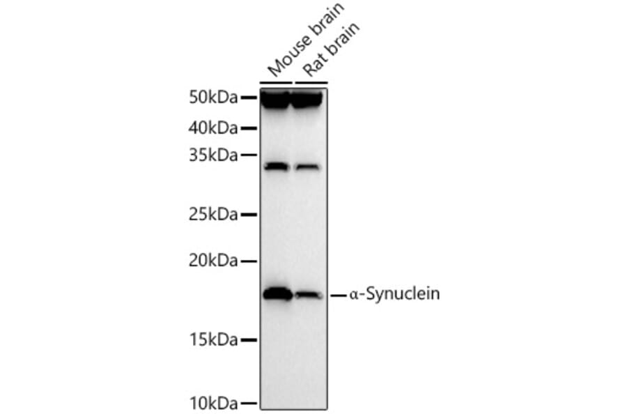 Western Blot - Anti-Alpha-synuclein Antibody (A88401) - Antibodies.com