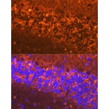 Immunofluorescence - Anti-Alpha-synuclein Antibody (A88401) - Antibodies.com