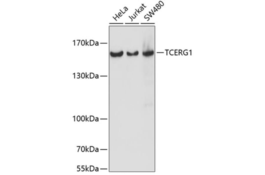Western Blot - Anti-CA150 Antibody (A88402) - Antibodies.com