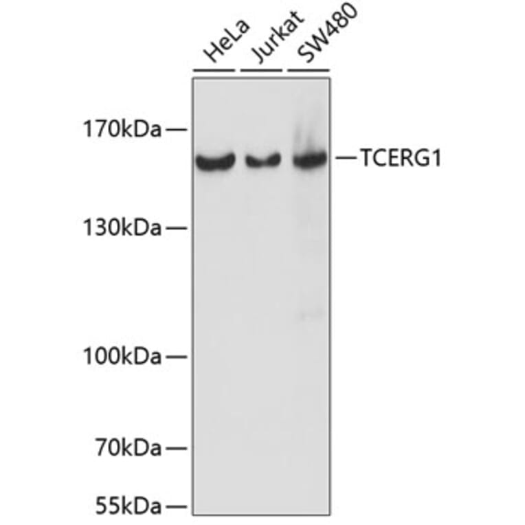 Western Blot - Anti-CA150 Antibody (A88402) - Antibodies.com