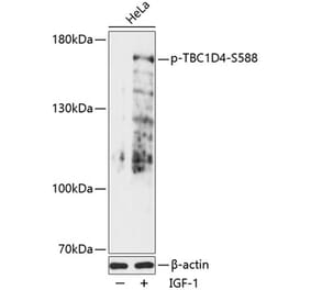 Western Blot - Anti-AS160 (phospho Ser588) Antibody (A88403) - Antibodies.com