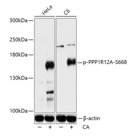 Western Blot - Anti-Myosin Phosphatase (phospho Ser668) Antibody (A88404) - Antibodies.com