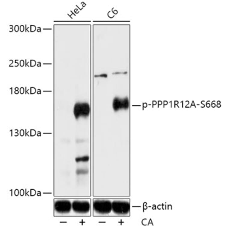 Western Blot - Anti-Myosin Phosphatase (phospho Ser668) Antibody (A88404) - Antibodies.com