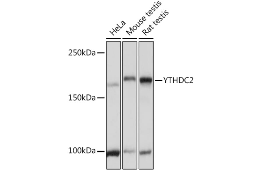 Western Blot - Anti-YTHDC2 Antibody (A88406) - Antibodies.com