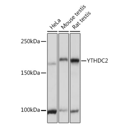 Western Blot - Anti-YTHDC2 Antibody (A88406) - Antibodies.com