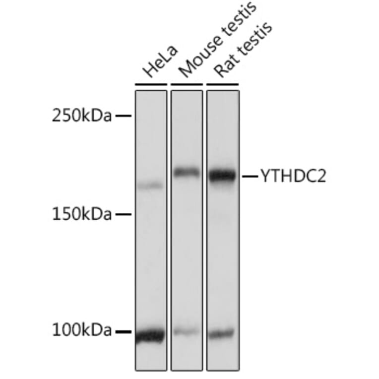Western Blot - Anti-YTHDC2 Antibody (A88406) - Antibodies.com