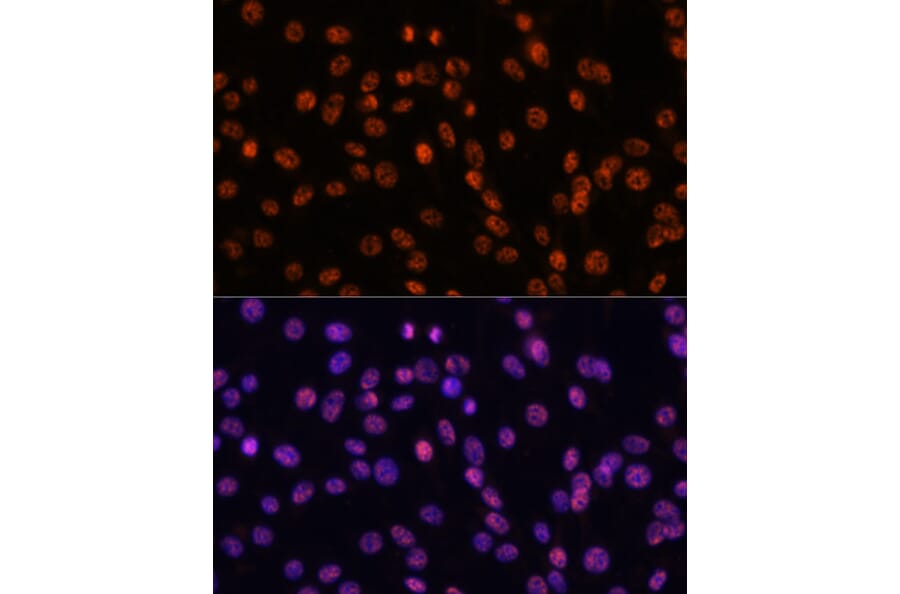 Immunofluorescence - Anti-SF3B1 Antibody (A88407) - Antibodies.com