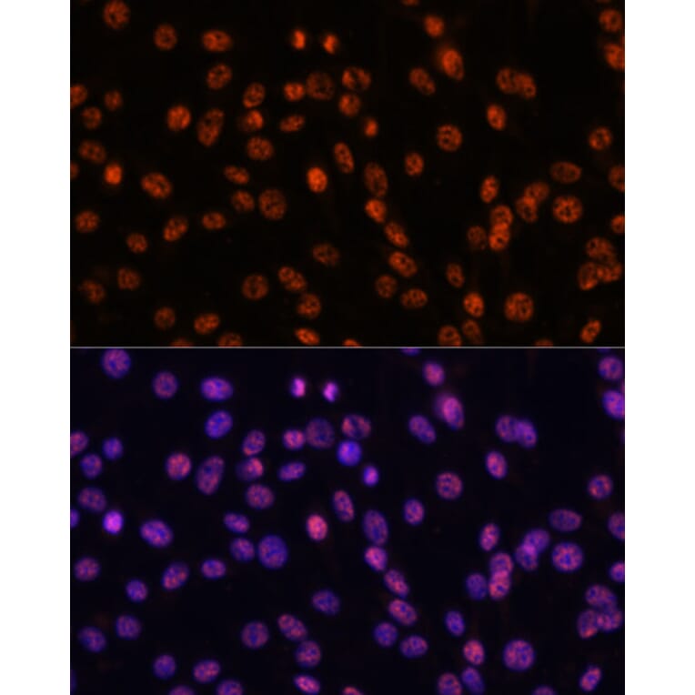 Immunofluorescence - Anti-SF3B1 Antibody (A88407) - Antibodies.com