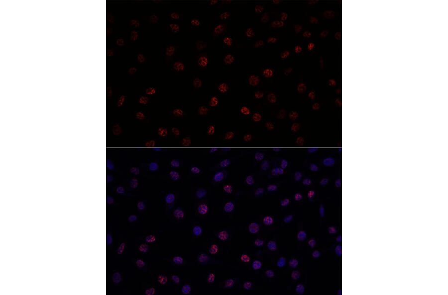 Immunofluorescence - Anti-SF3B1 Antibody (A88407) - Antibodies.com