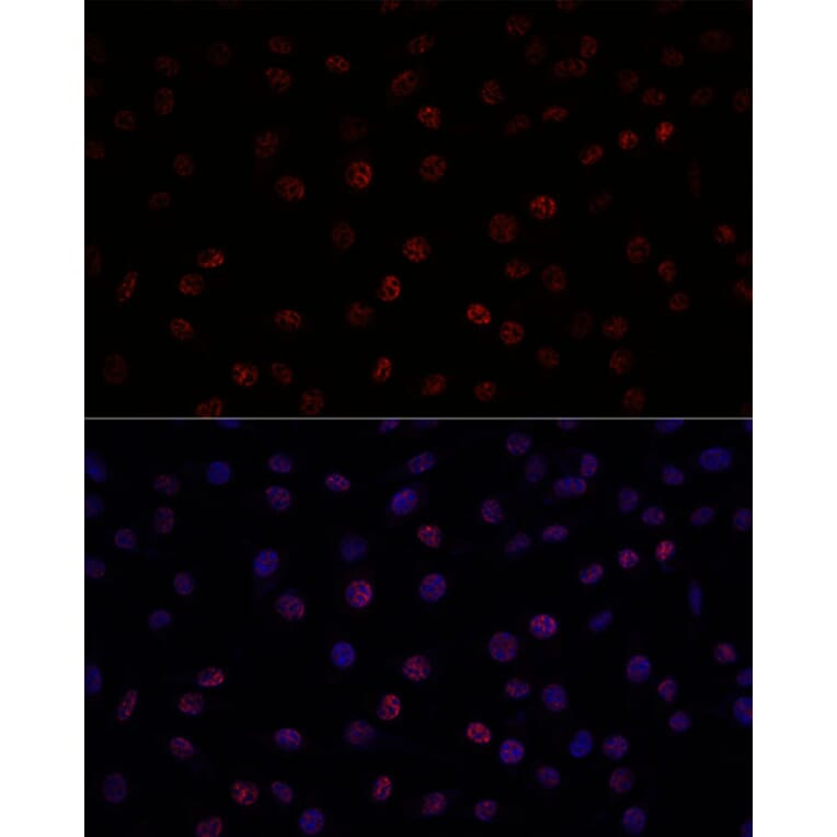 Immunofluorescence - Anti-SF3B1 Antibody (A88407) - Antibodies.com