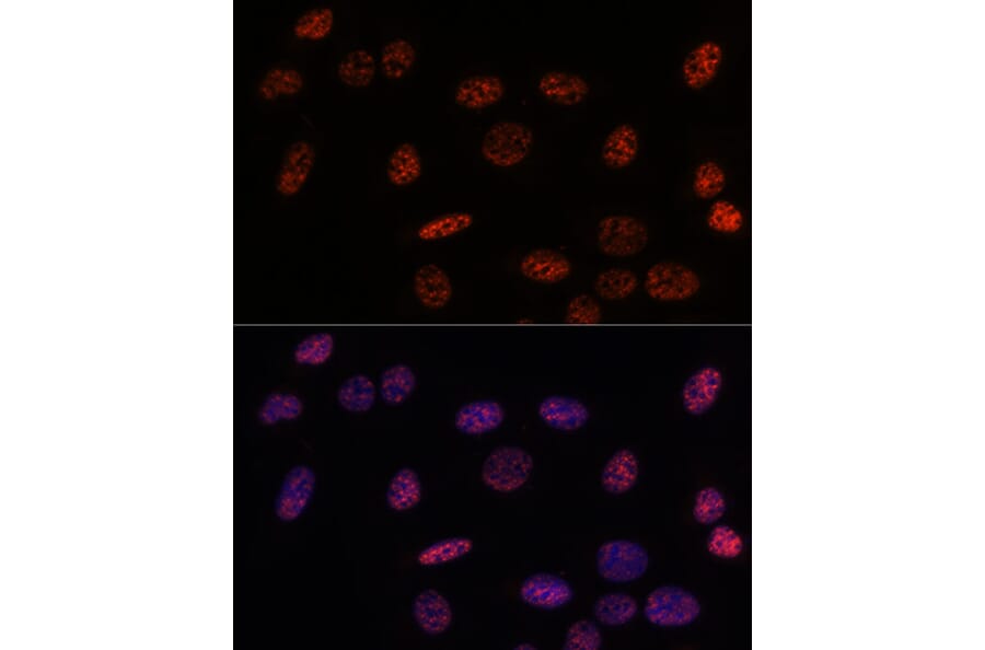 Immunofluorescence - Anti-SF3B1 Antibody (A88407) - Antibodies.com