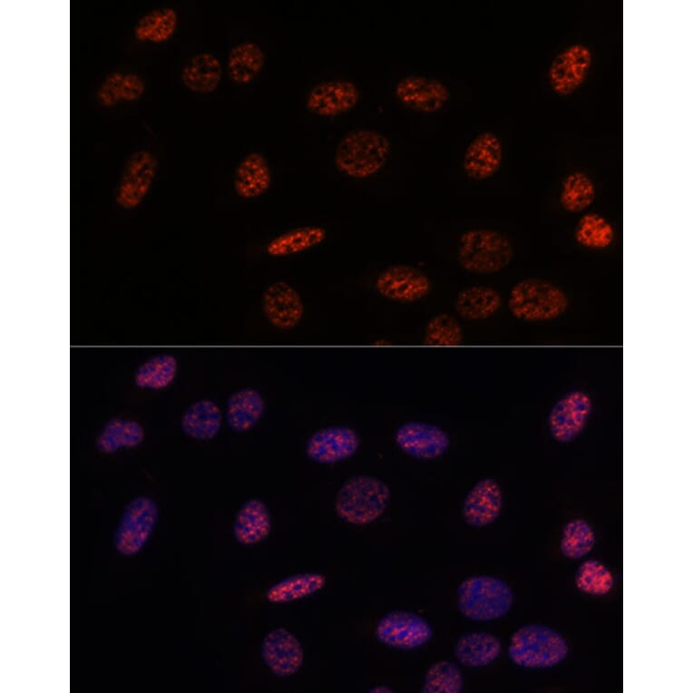 Immunofluorescence - Anti-SF3B1 Antibody (A88407) - Antibodies.com