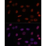 Immunofluorescence - Anti-SF3B1 Antibody (A88407) - Antibodies.com