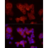 Immunofluorescence - Anti-VEGF Receptor 3 Antibody (A88408) - Antibodies.com