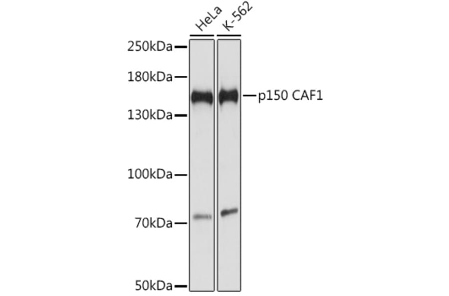 Western Blot - Anti-p150 CAF1/CAF Antibody (A88409) - Antibodies.com