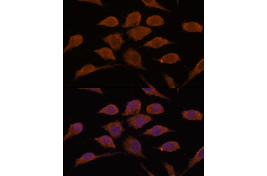 Immunofluorescence - Anti-USP19 Antibody (A88410) - Antibodies.com