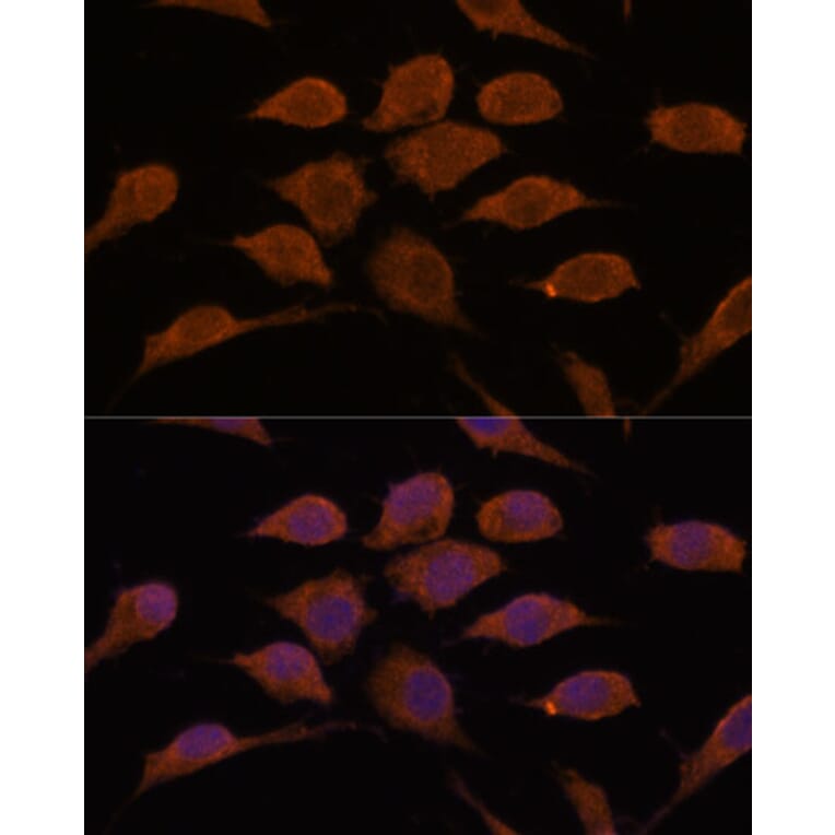 Immunofluorescence - Anti-USP19 Antibody (A88410) - Antibodies.com