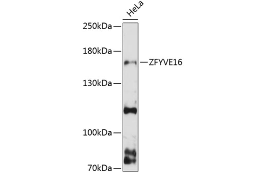 Western Blot - Anti-ZFYVE16 Antibody (A88411) - Antibodies.com