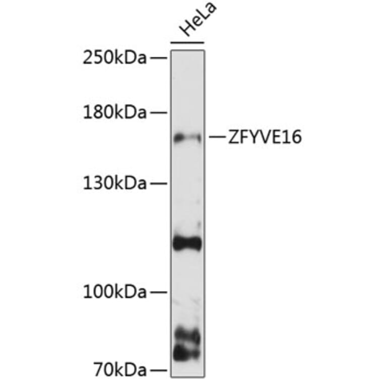 Western Blot - Anti-ZFYVE16 Antibody (A88411) - Antibodies.com