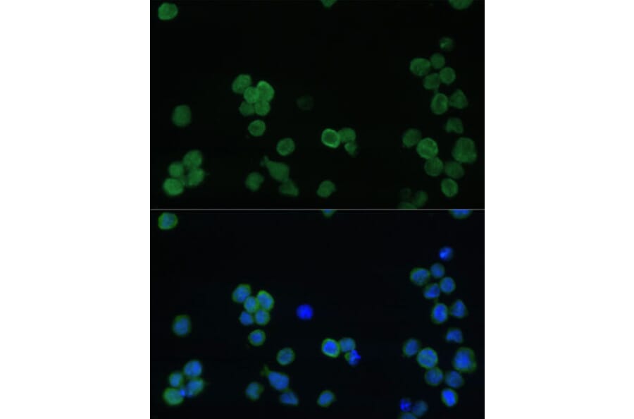 Immunofluorescence - Anti-CD42b Antibody (A88412) - Antibodies.com