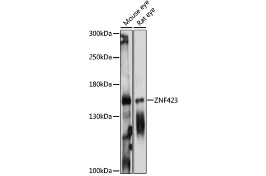 Western Blot - Anti-ZNF423 Antibody (A88413) - Antibodies.com