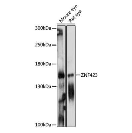 Western Blot - Anti-ZNF423 Antibody (A88413) - Antibodies.com