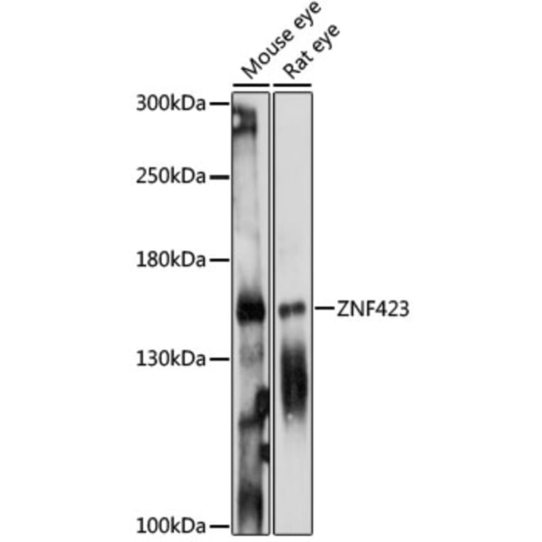 Western Blot - Anti-ZNF423 Antibody (A88413) - Antibodies.com