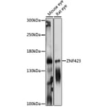 Western Blot - Anti-ZNF423 Antibody (A88413) - Antibodies.com